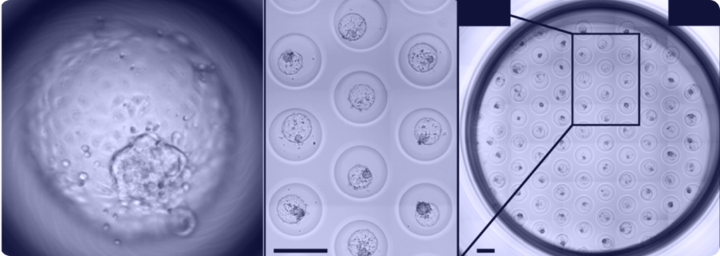 Human blastoids faithfully model human blastocyst